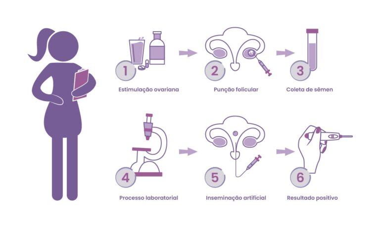 Inseminação artificial - Fertilidade.org