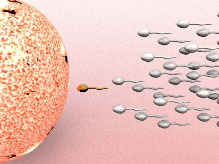 fertilização in vitro - Infertilidade masculina