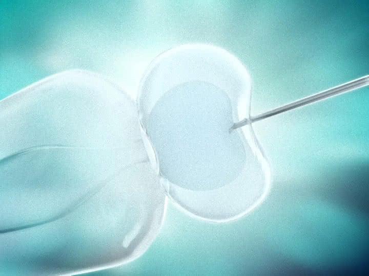 A técnica de Fertilização in vitro na reprodução humana