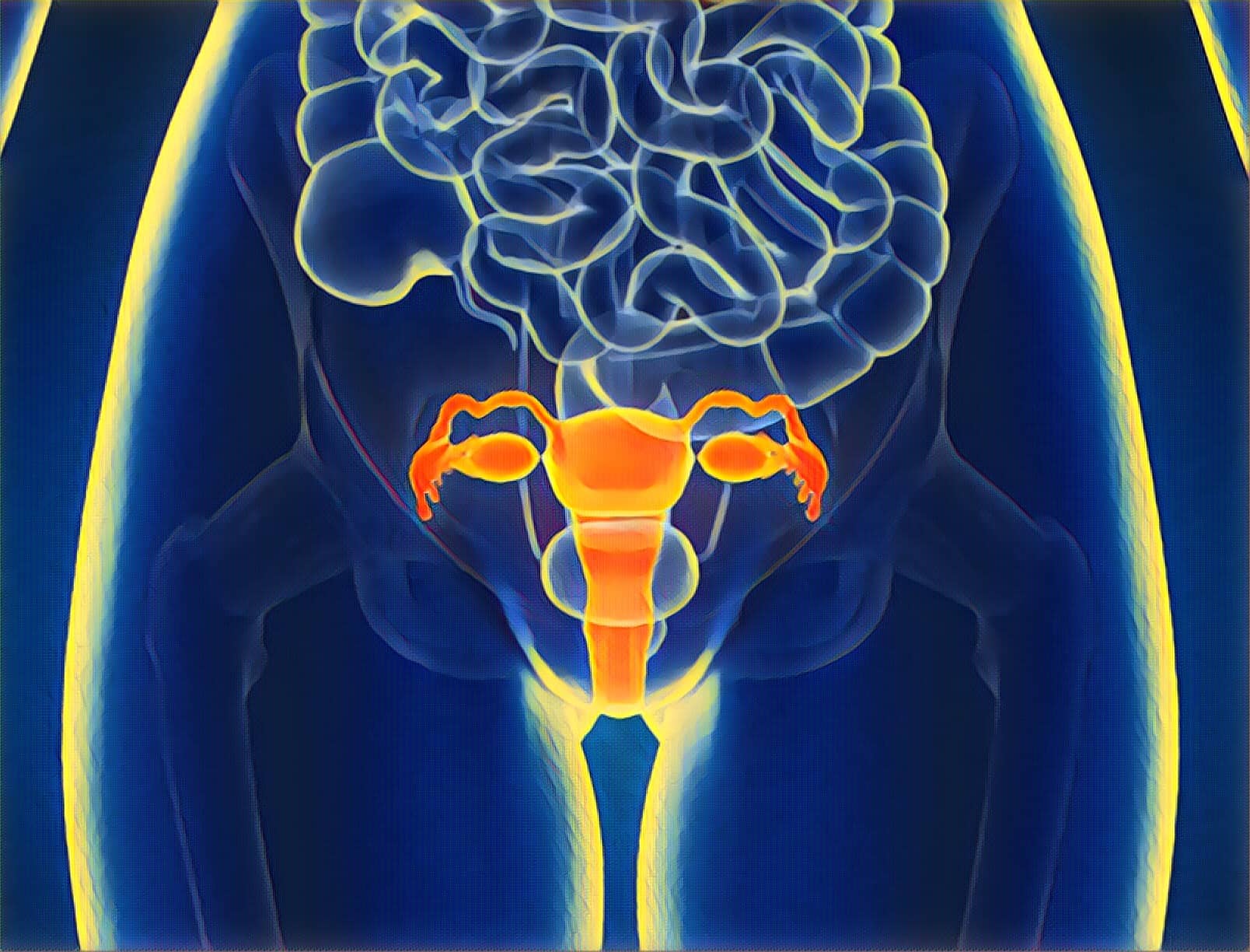 Endometriose: o Conselho de um Médico sobre Viver Com uma Doença Dolorosa