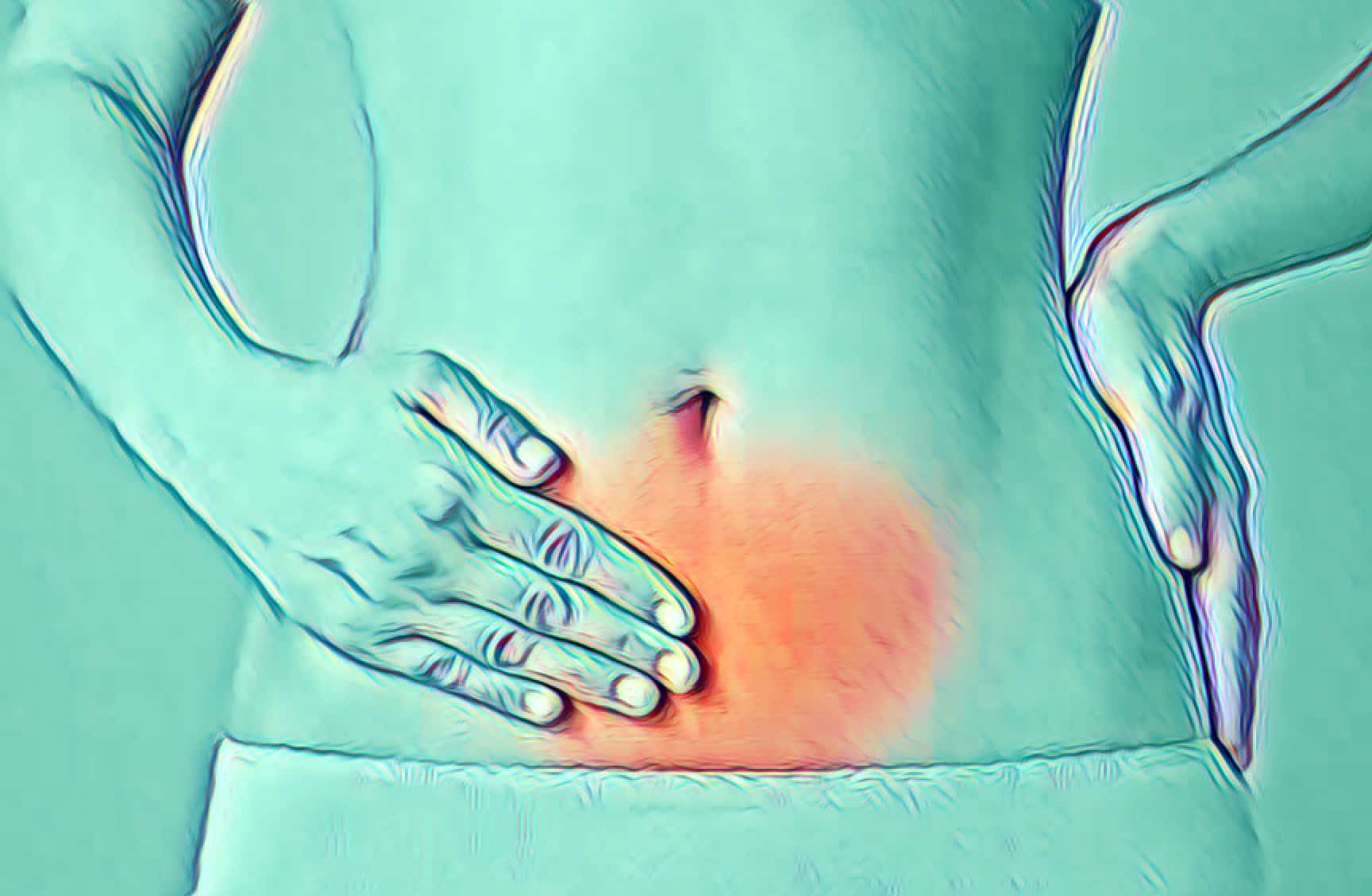 Fertilidade após a embolização uterina