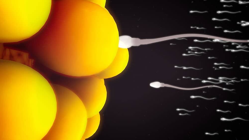 Imagem de uma seringa sendo inserida no útero de uma mulher para realização de inseminação intrauterina.