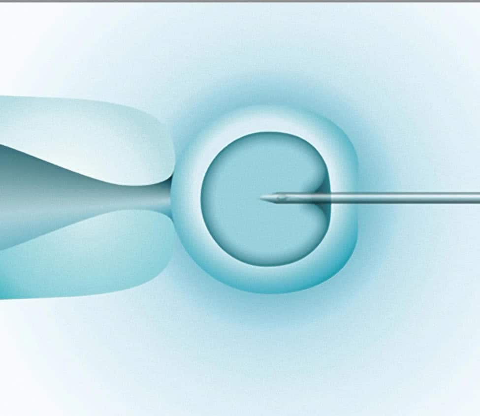 é introduzido o espermatozóide dentro do óvulo com uma agulha mais fina que o diâmetro de um fio de cabelo humano