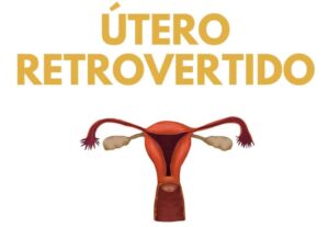 utero-retrovertido