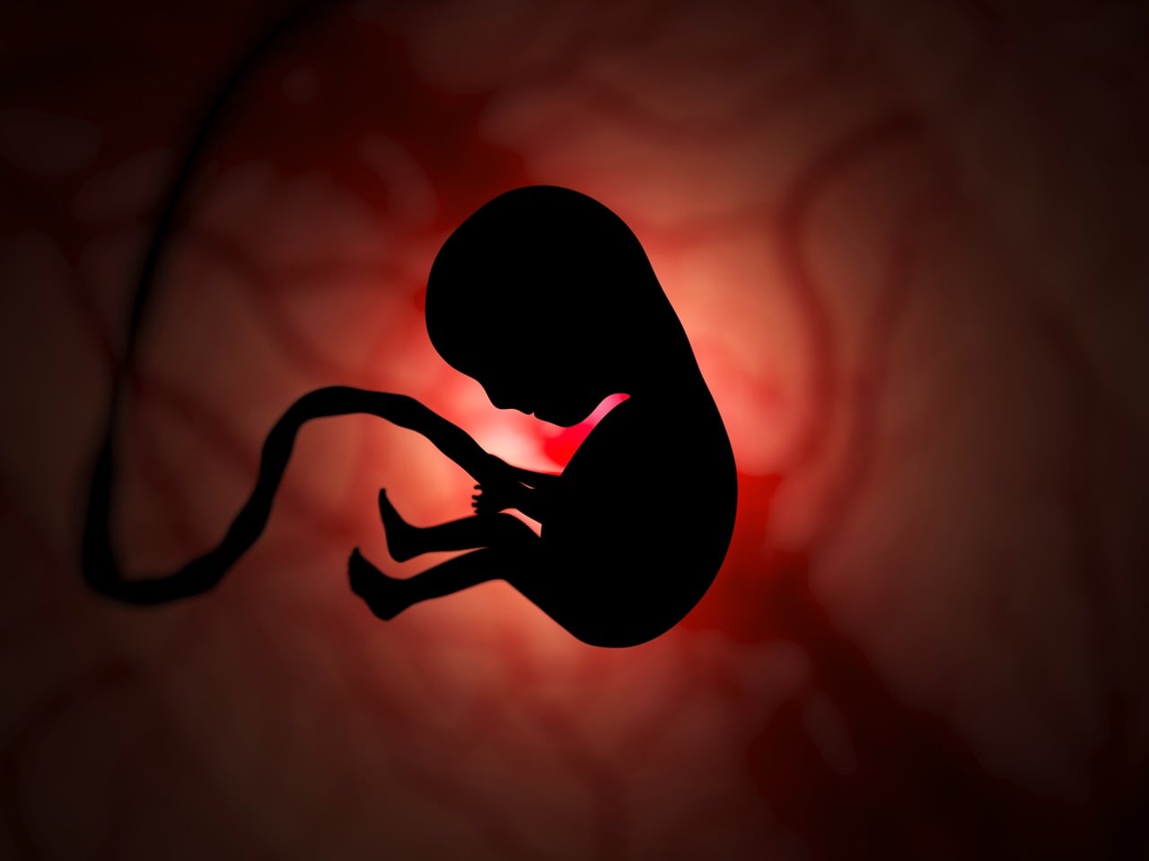 Imagem de uma ilustração médica mostrando uma gravidez ectópica, em que o embrião se desenvolve fora do útero, geralmente nas trompas de Falópio.