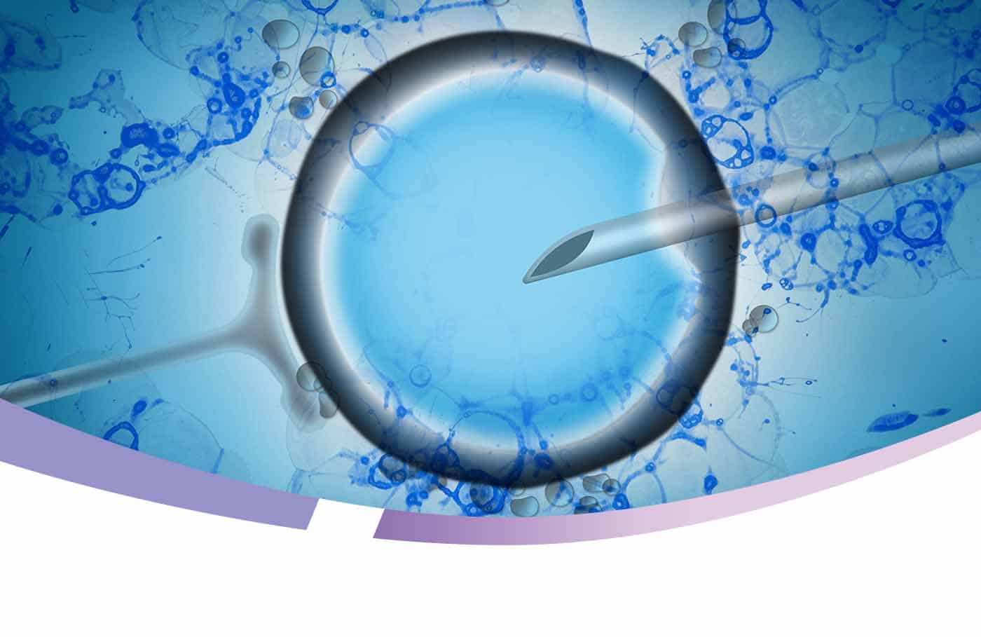 Fertilidade: Tratamentos em Reprodução Humana — 2
