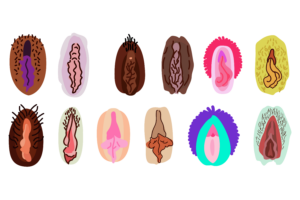 Tipos anatômicos de vagina