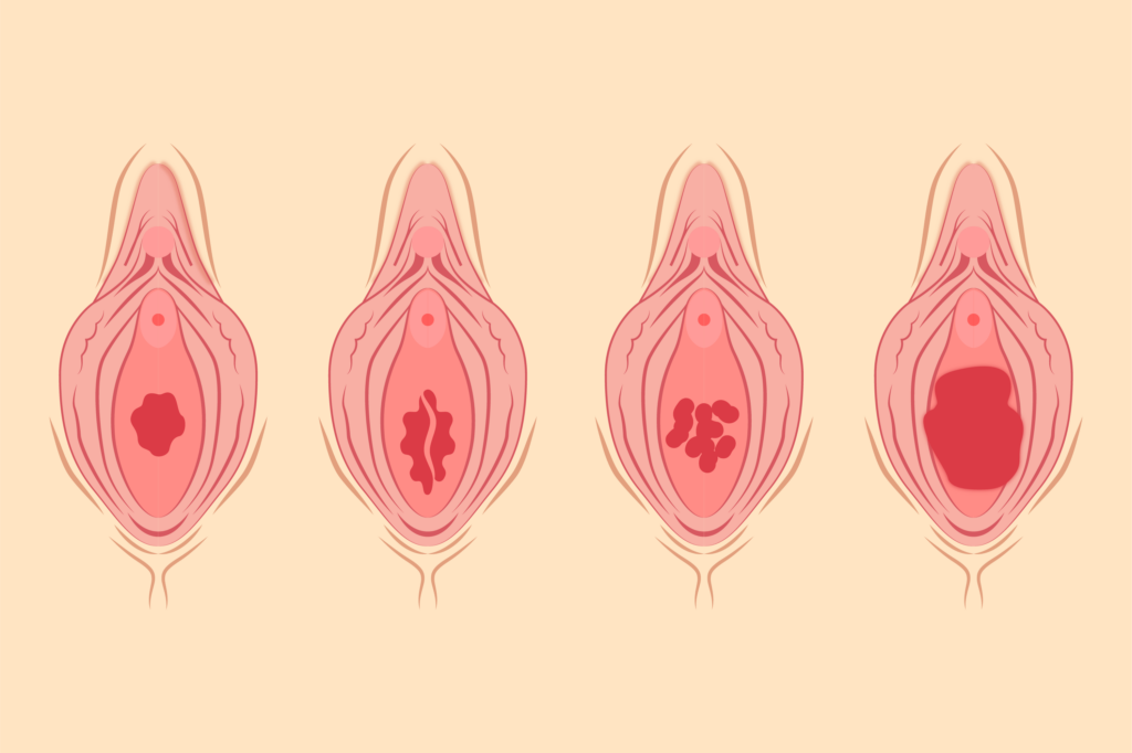 Vulva e vagina: entenda a diferença e a importância de cada parte