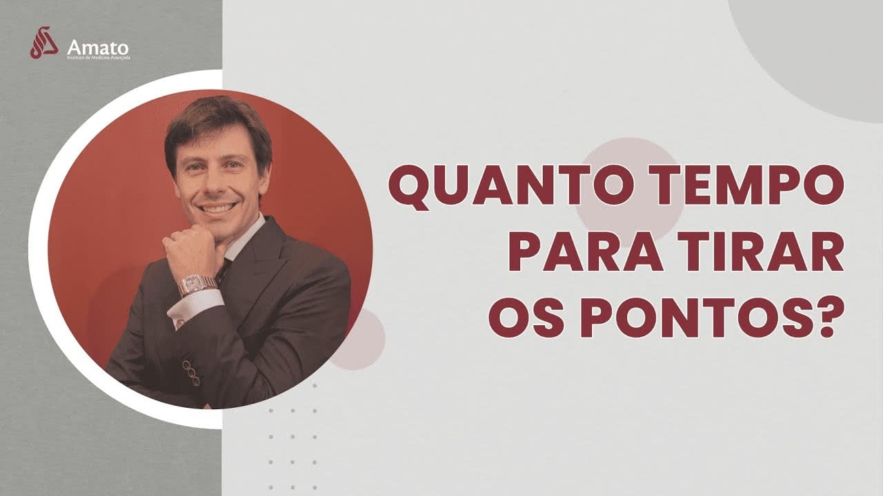 Quanto Tempo para Tirar os Pontos?