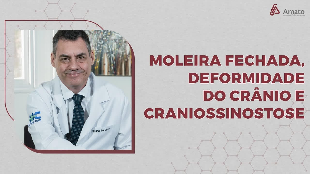 Moleira Fechada, Deformidade de Crânio e Craniossinostose. Qual é a diferença entre eles???