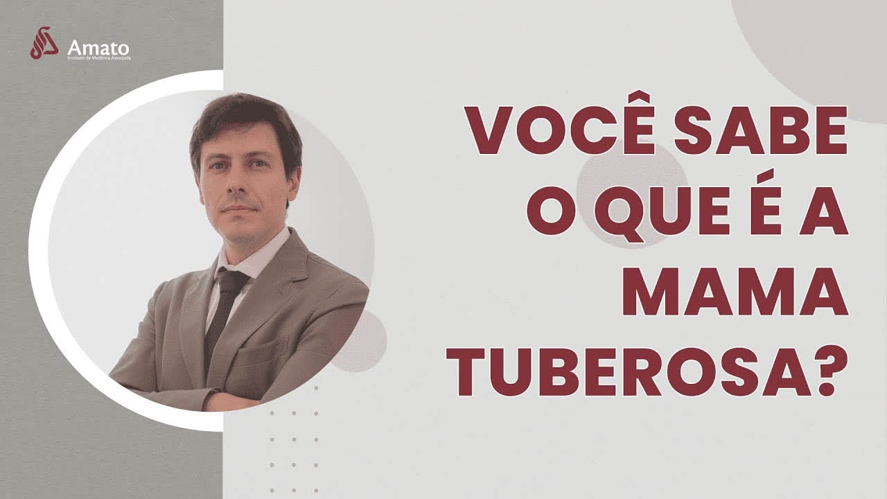 Você sabe o que é a Mama Tuberosa?