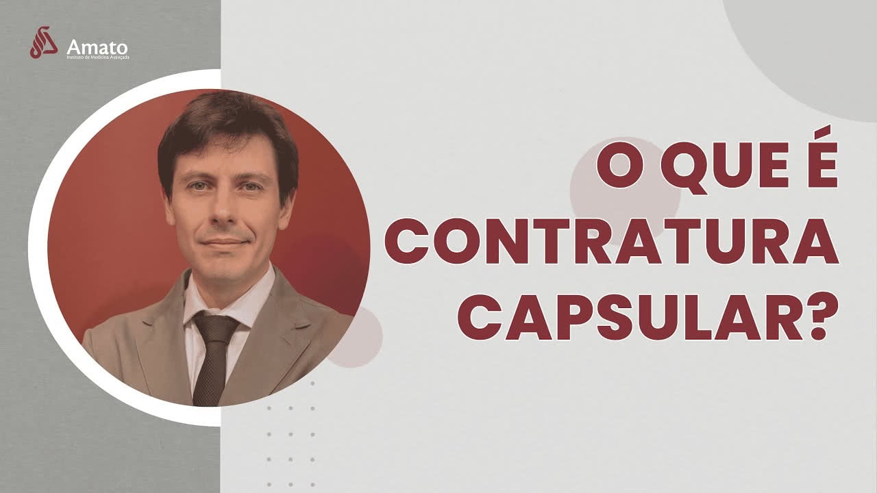 O que é Contratura Capsular?